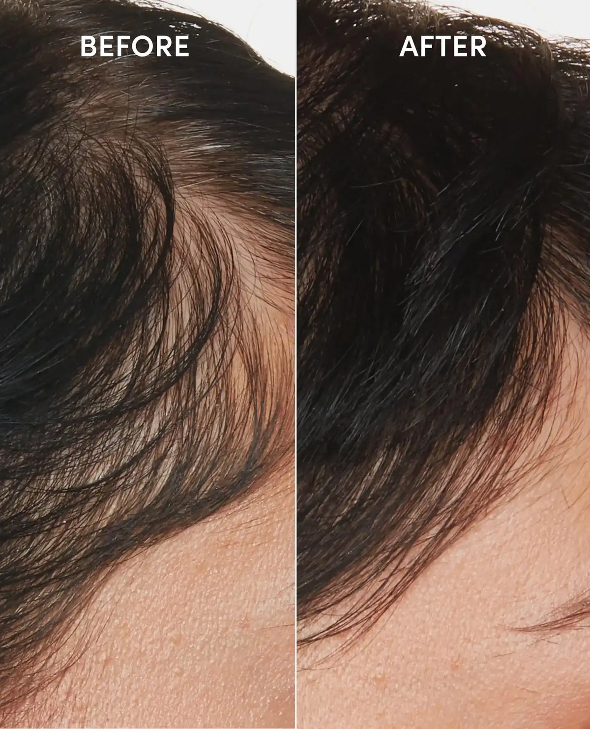 Scalp Serum