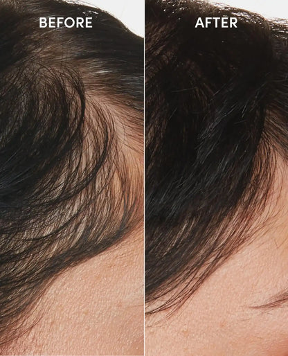 Scalp Serum
